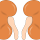 What You Should Know About Kidney Transplants