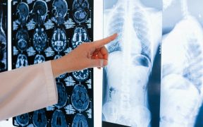 5 Tips for Starting Your Career in Radiology